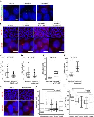 Patient-derived and gene-edited pluripotent stem cells lacking NPHP1 recapitulate juvenile nephronophthisis in abnormalities of primary cilia and renal cyst formation